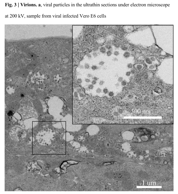 I study viruses: How our team isolated the new coronavirus to